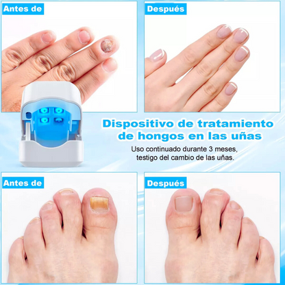 Ony Clean Pro